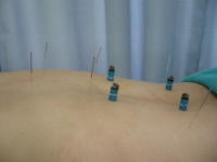 �Ԑڋ��Ȃ̂ŋɒ[�ɔM���Ȃ������c��܂���